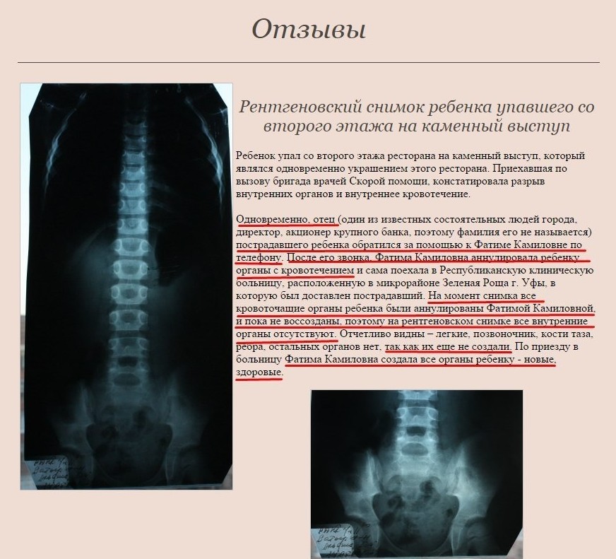 Мошенники в этой сфере были всегда. Только посмотрите на этот отзыв об услугах одной из уфимских целительниц  медицина, органы, транспланталогия